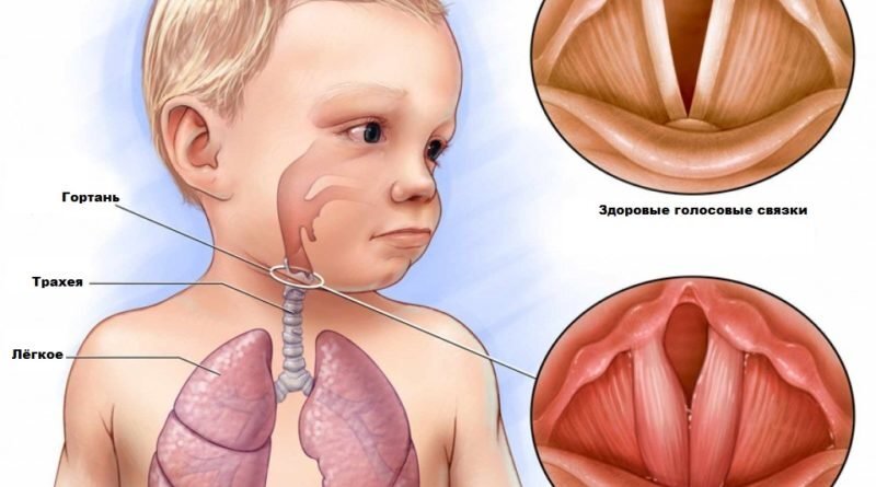 Чем лечить горло ребенку