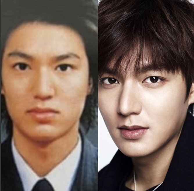 Фото корейских актеров до и после пластики
