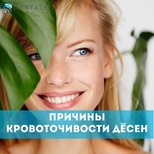 6 причин кровоточивости десен. Стоматология Дентал Кит.