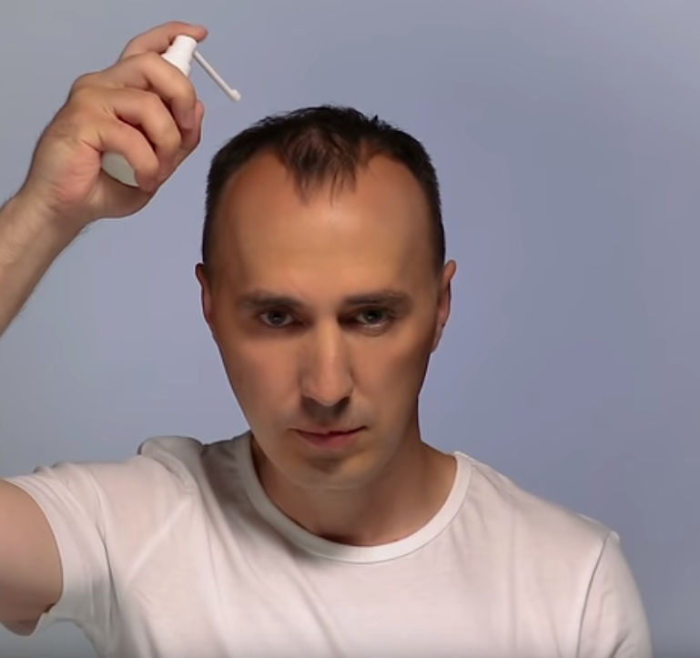 Средства против перхоти