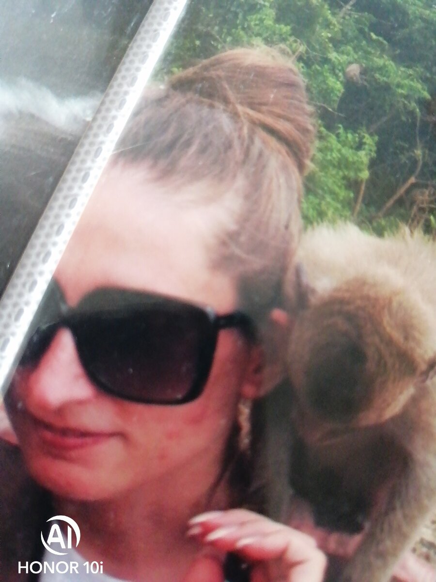 Вот такой была моя кожа! 