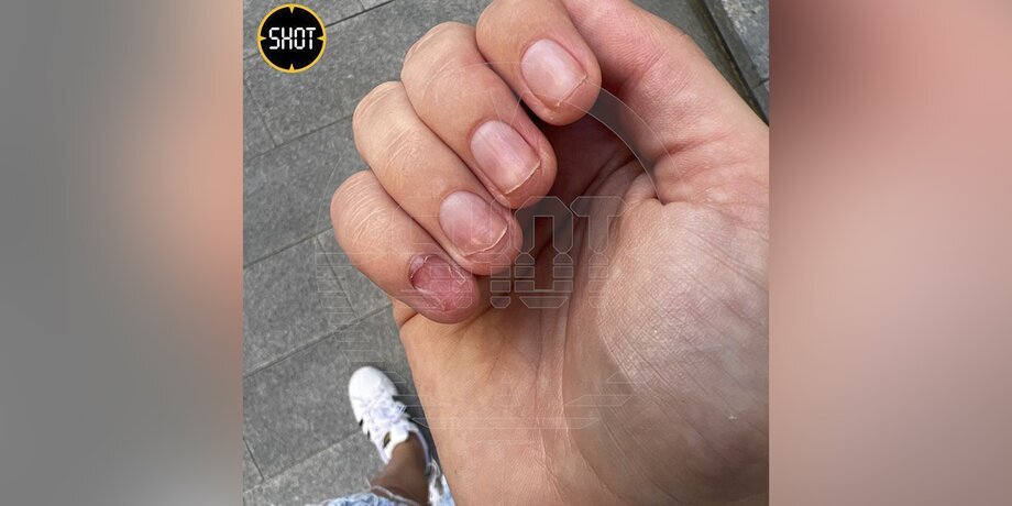 Фото: телеграм-канал SHOT 