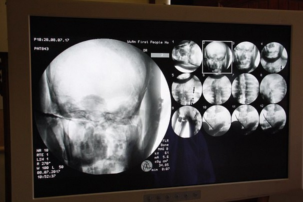 Компьютерная томография золотой статуи мастера Ци Сяня, изображающей труп внутри статуи (Источник: храм Дин Хуэй)