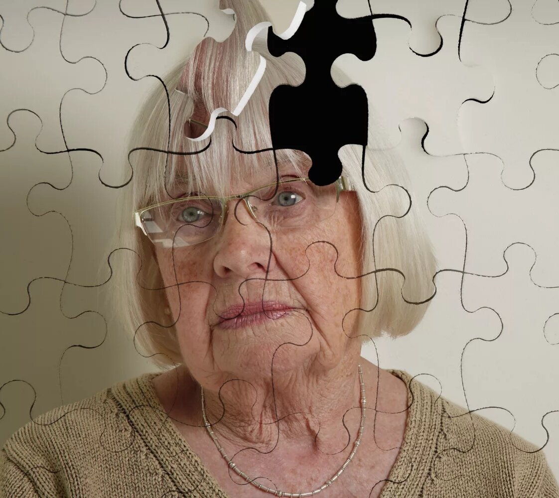 Слабоумие картинки. Что такое деменция у женщин. Слабоумие у пожилых. Лицо человека с деменцией. Болезнь Альцгеймера картинки.
