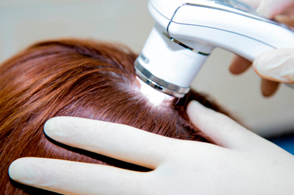 Что такое кола терапия для волос