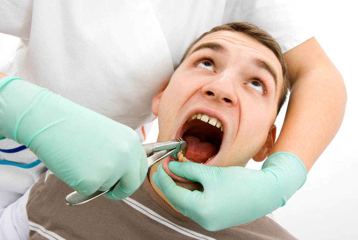 Удаление нерва зуба в Москве: процедура, чистка каналов и стоимость