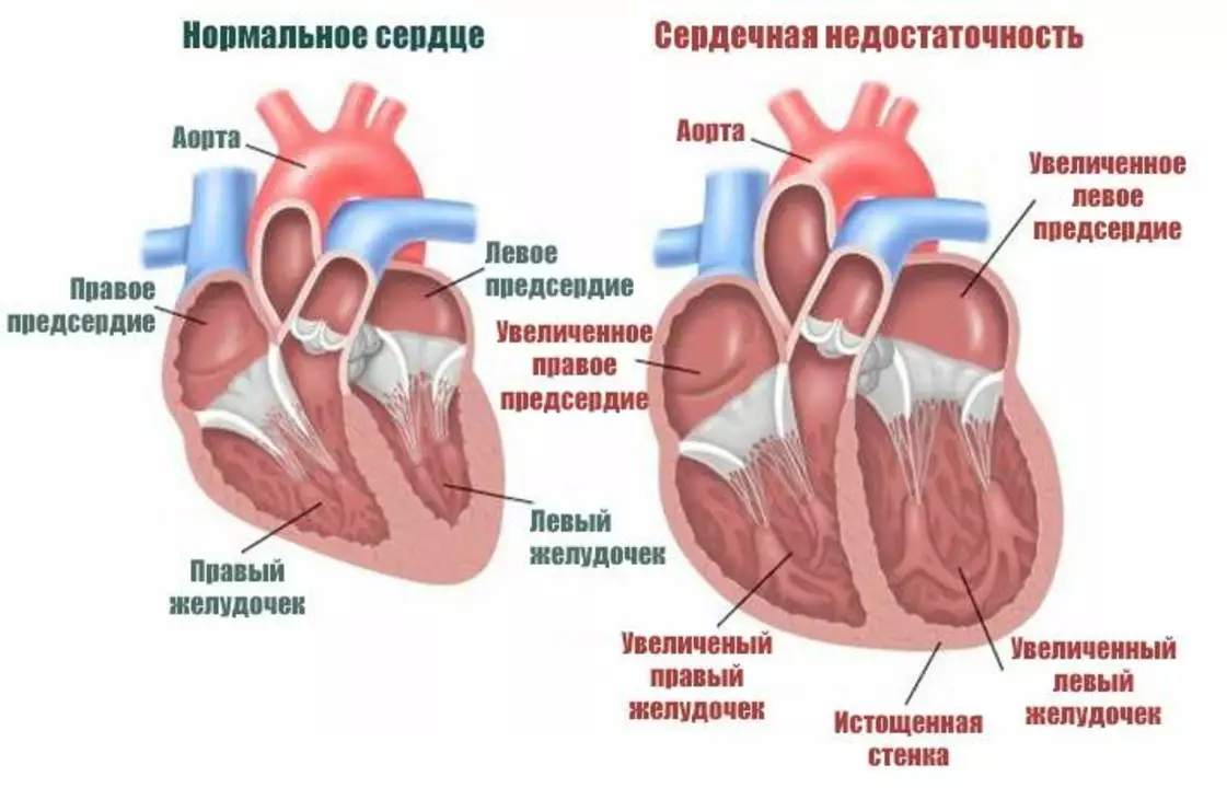 Строение сердца собаки. Хроническая сердечная и сосудистая недостаточность. Сердце при хронической сердечной недостаточности. Серлечнаянедостаточность.