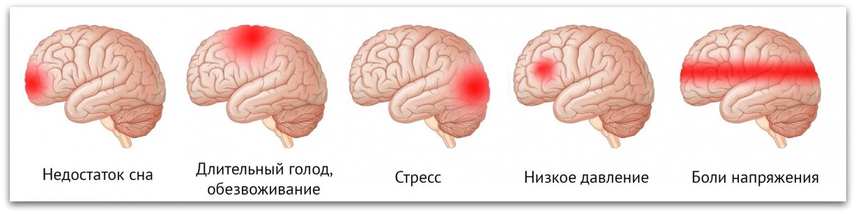 Болит левое мозг