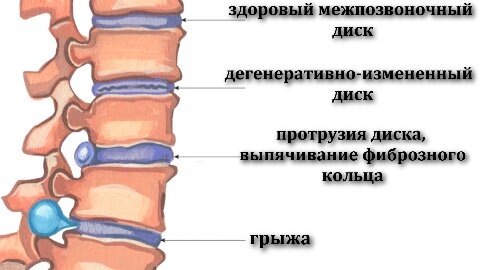 Дугоотросчатые суставы шейного отдела