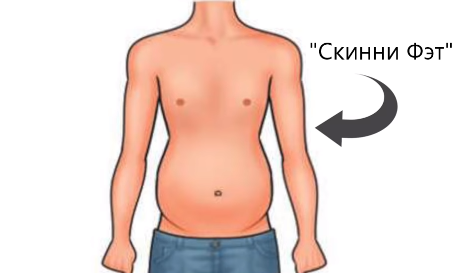 Скинни фэт что это. Скинни фэт. Состояния скинни-фэт. Форма скинни фэт у мужчин. Скинни фэт фигура мужчины.