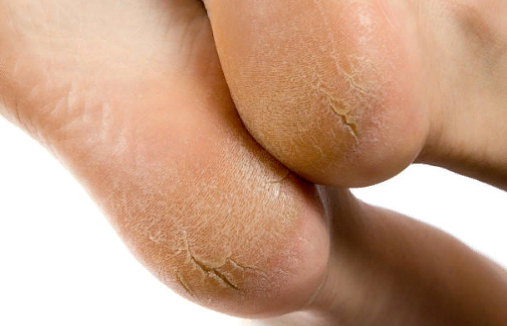 Источник: istockphoto.com