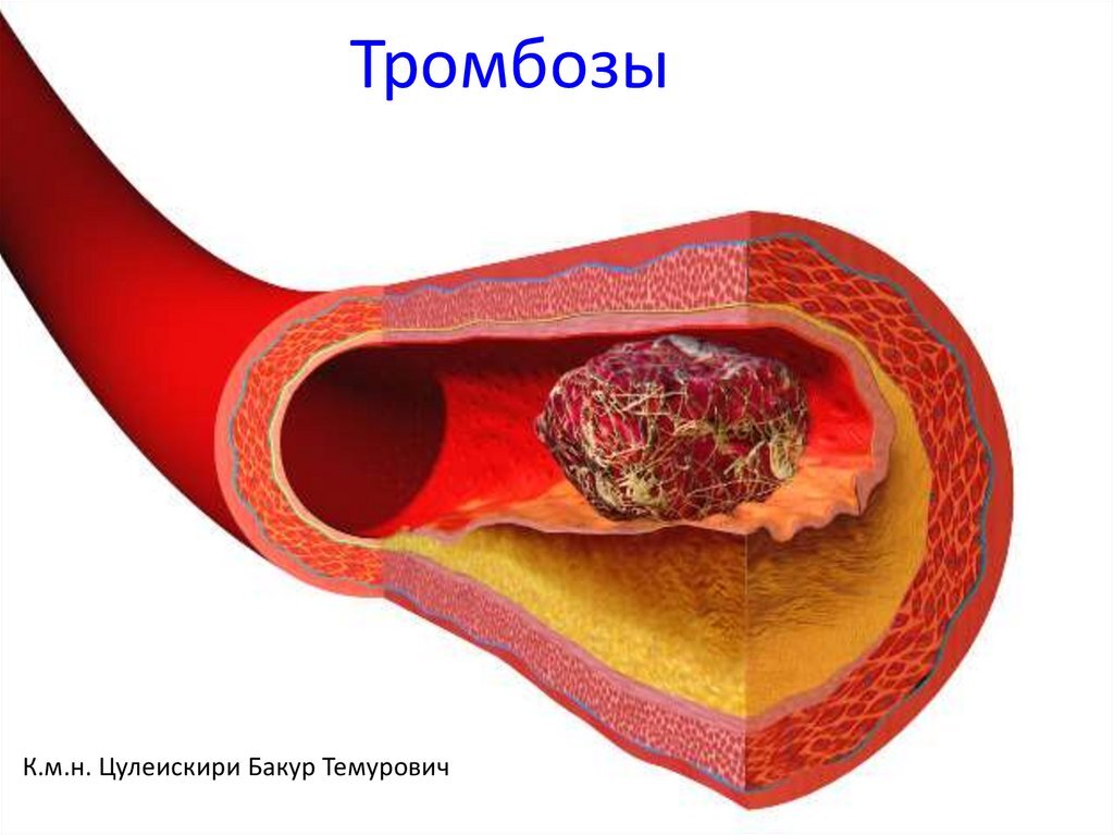 После острого