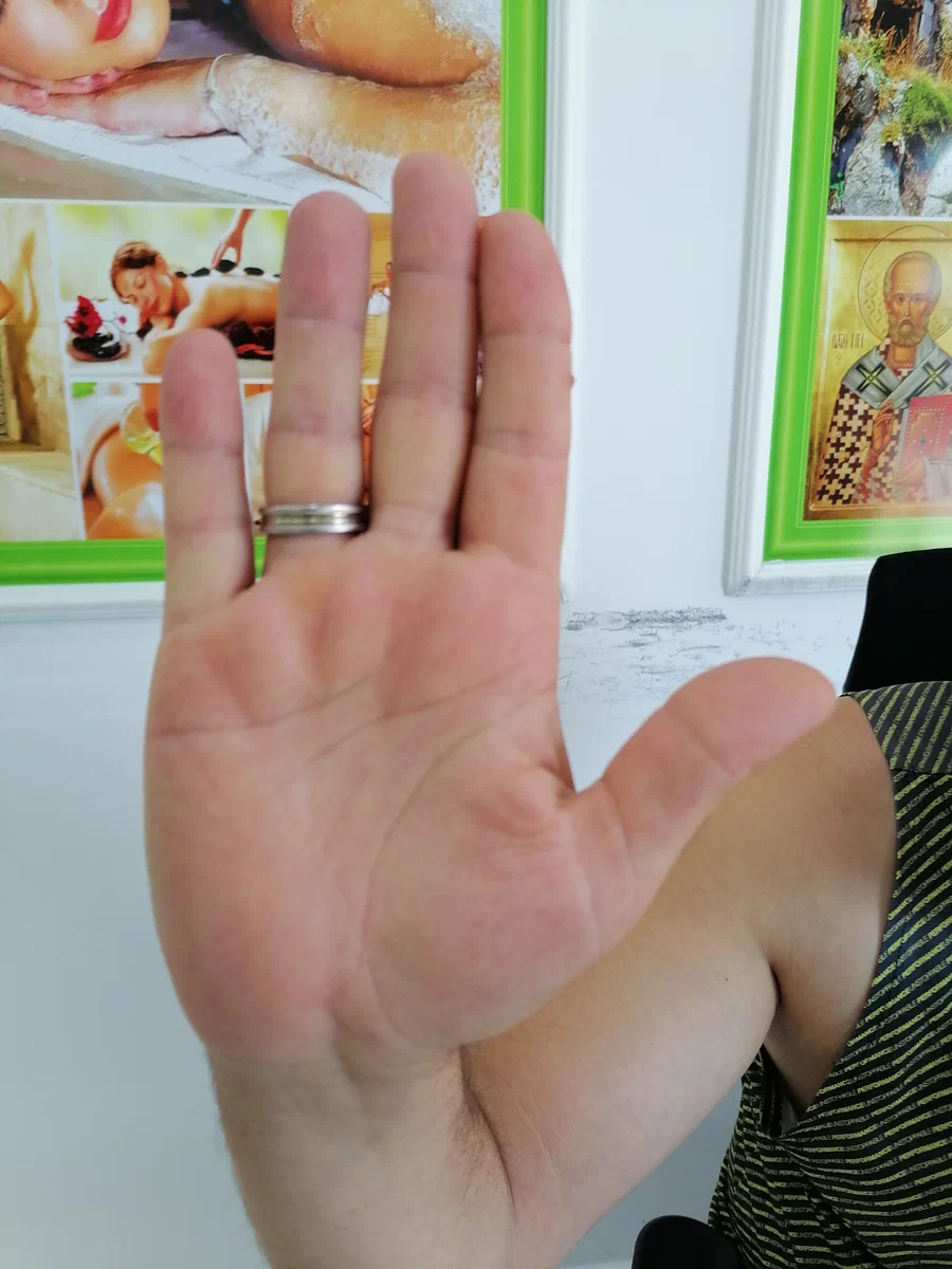 Правая рука Касима, 35 лет, правша. Из личного архива.