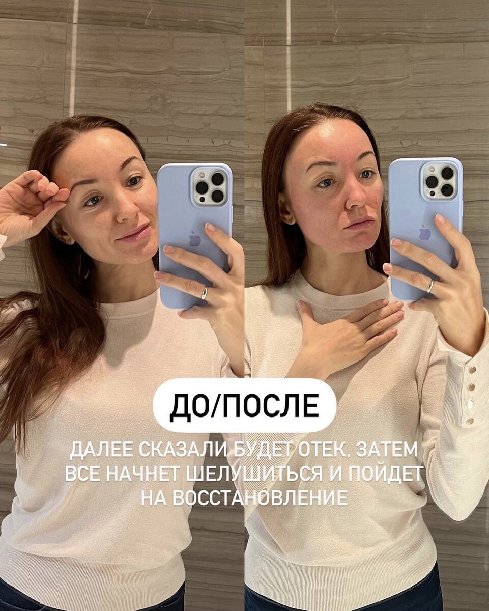 🔥ВСЕ ЛИЦО ГОРЕЛО ОГНЁМ🥵 я думала, что не выдержу… | СТОП возраст с Юлией  Сайфуллиной | Дзен