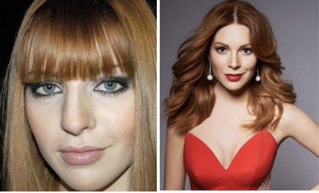 Наталья Подольская «до и после» операции носа. Источник фото: yandex.ru