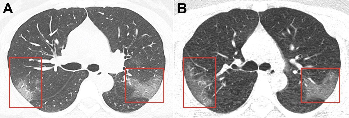 Source: pubs.rsna.org