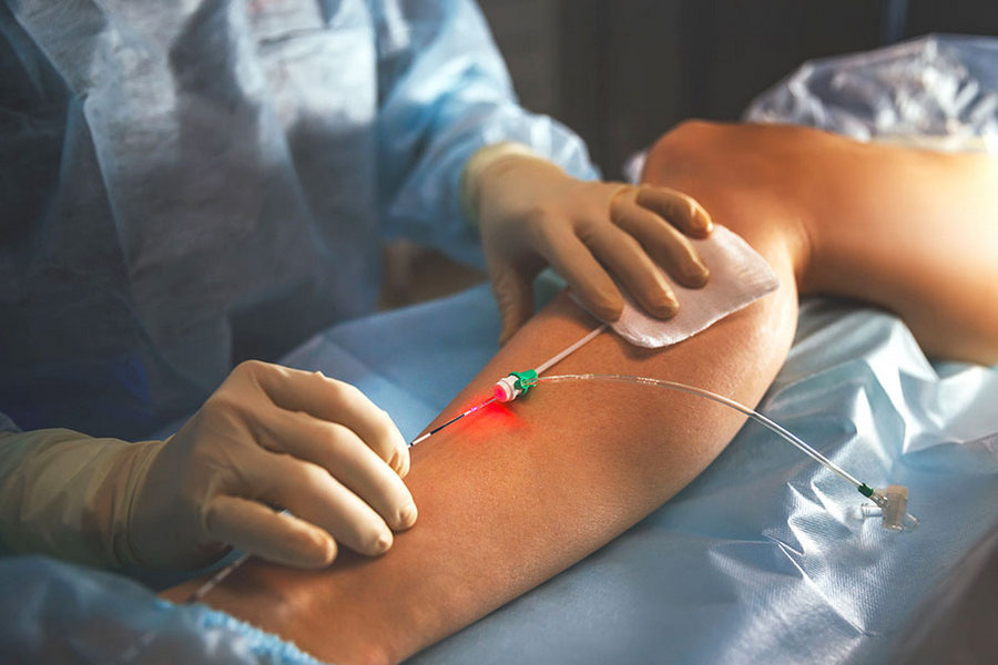 Источник:  https://1nsk.ru/news/articles/lechenie-varikoza-na-nogah.html