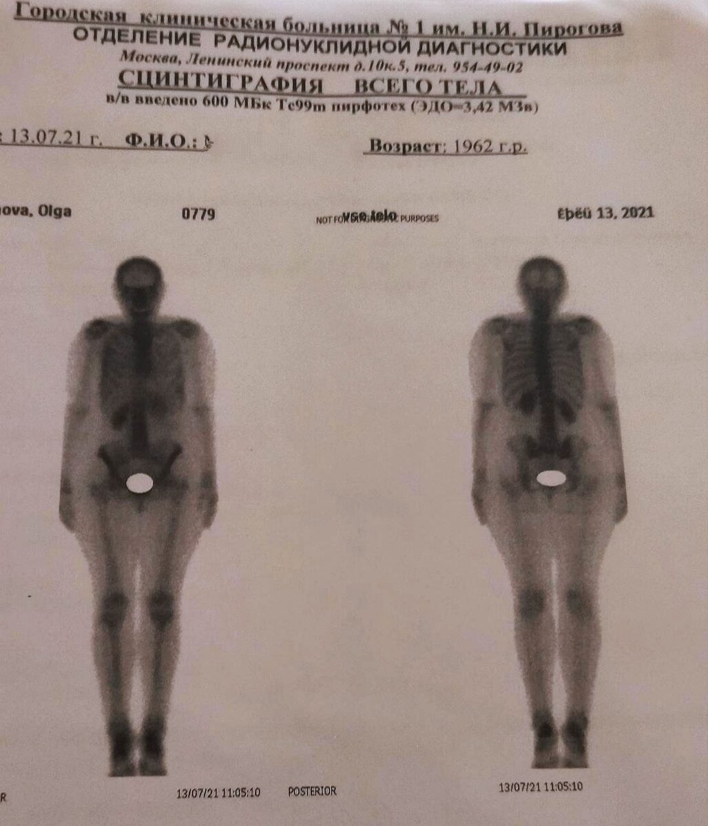 На сегодняшний день это моë лучшее фото, однозначно. 