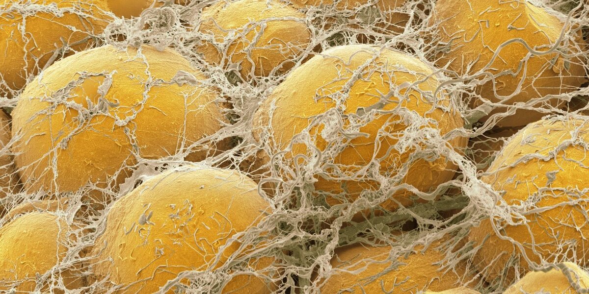 Жировые клетки человека