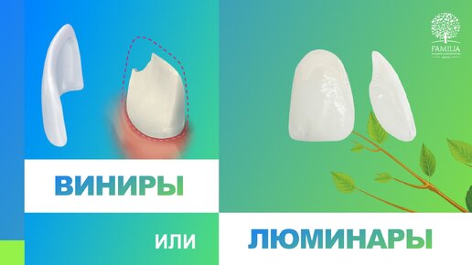 ​⁉️​ Виниры или люминиры?