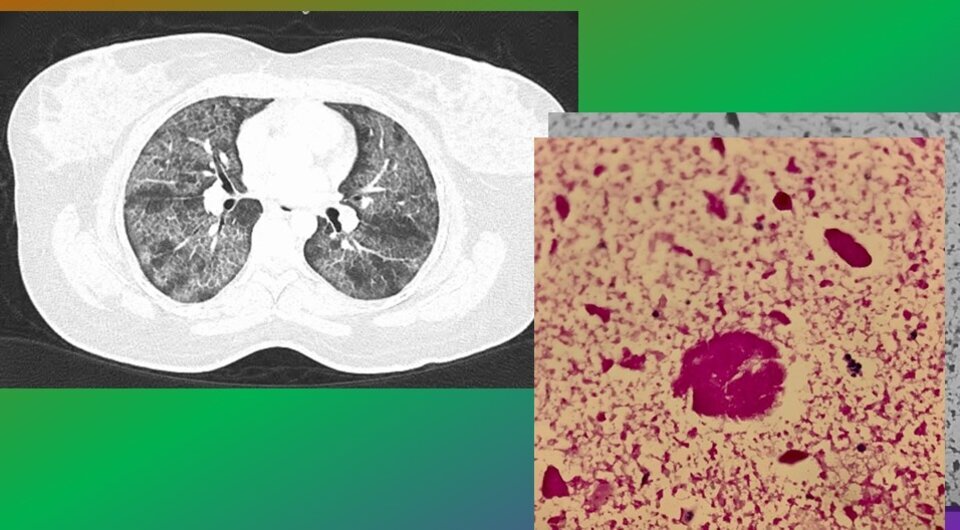   Cara Louise Weldrick et al. / BMJ Case Reports, 2023