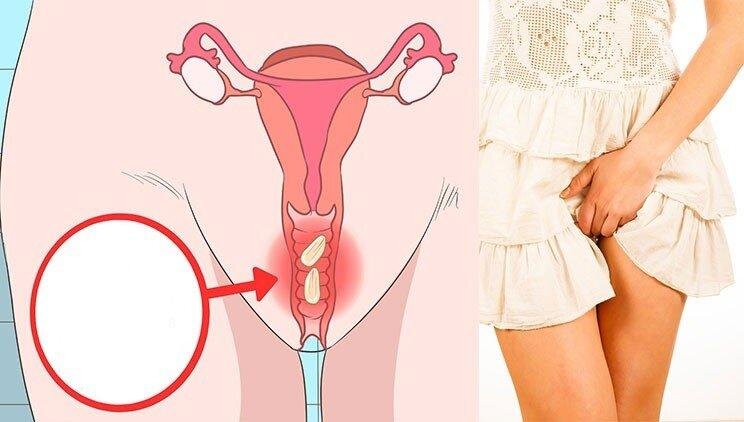 (фото: vashmedsovetnik.com)