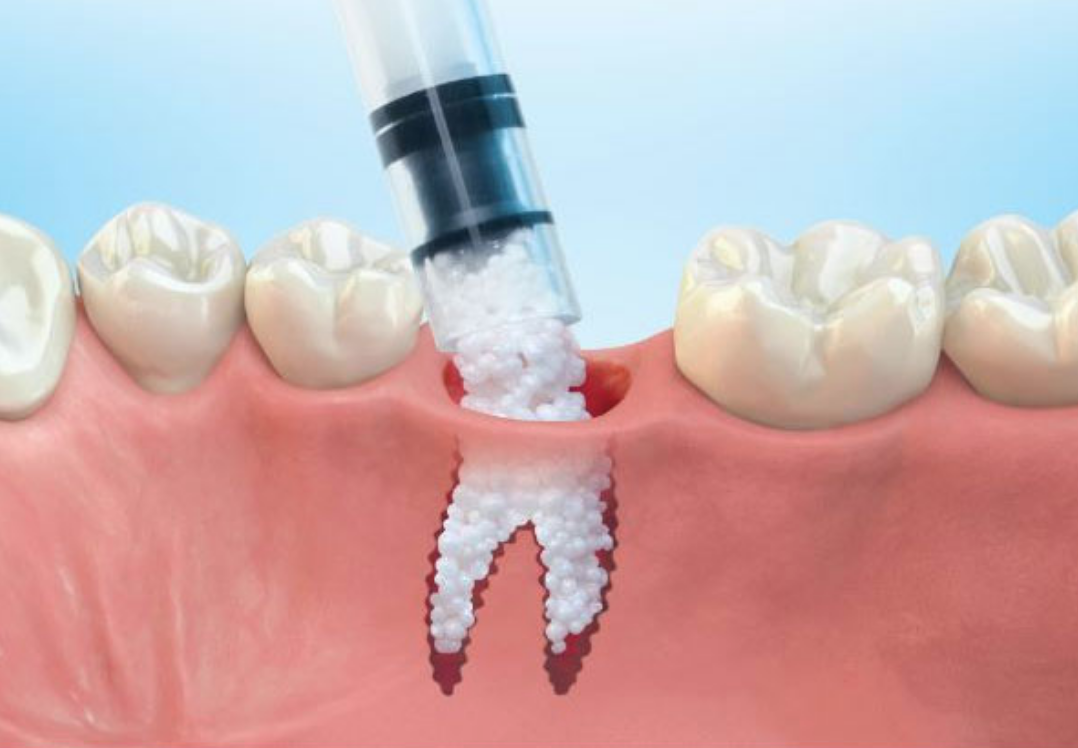 Ученые научились выращивать зубы, а стоматологи против из-за страха потерять работу. Так ли это?