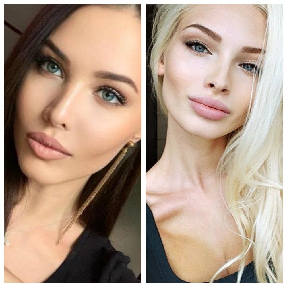 Тимати до и после пластики фото