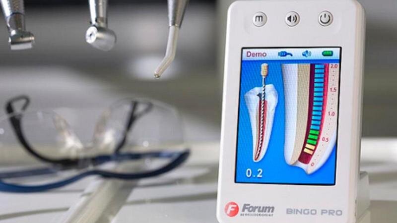 апекслокатор