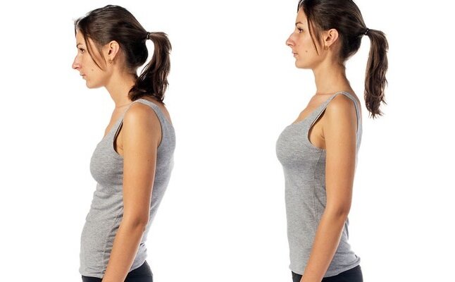                             Неправильная осанка                                                 Правильная осанка