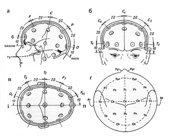 Система ээг. Электроэнцефалография схема 10 20. Схема 10-20 наложение электродов. Схема наложения электродов ЭЭГ. Схема расположения электродов 10-20 ЭЭГ.