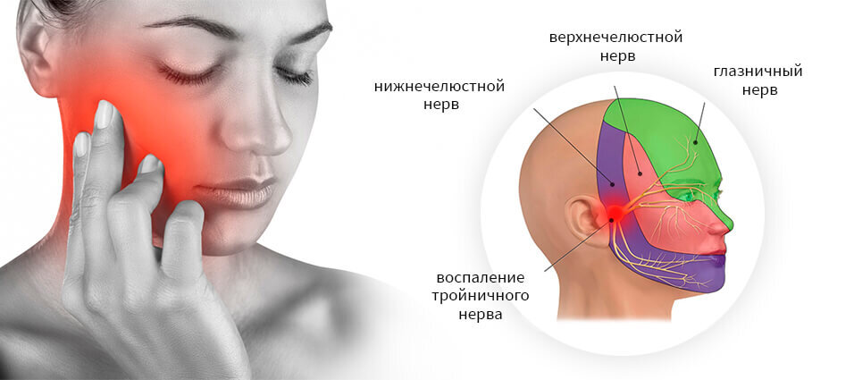 Как вылечить воспаление тройничного нерва?: статьи медцентра Оксфорд Медикал Запорожье