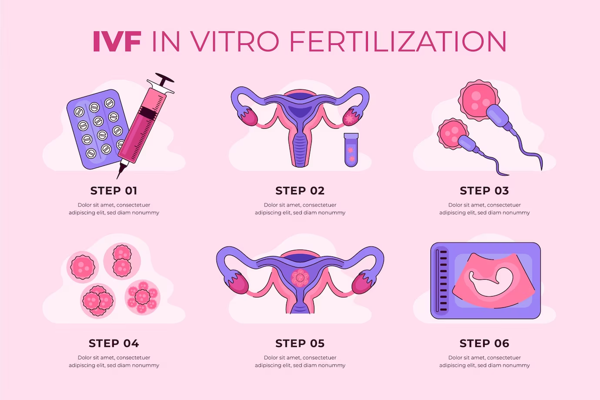 Бесплодие и экстракорпоральное оплодотворение(ЭКО) | Здоровье-Здорово | Дзен
