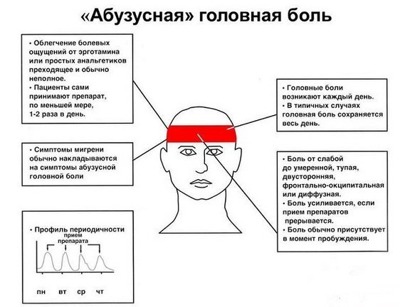 Голова болит от того, что «внутричерепное давление повысилось». Так ли это?