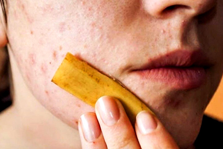 Источник фото: Яндекс.картинки