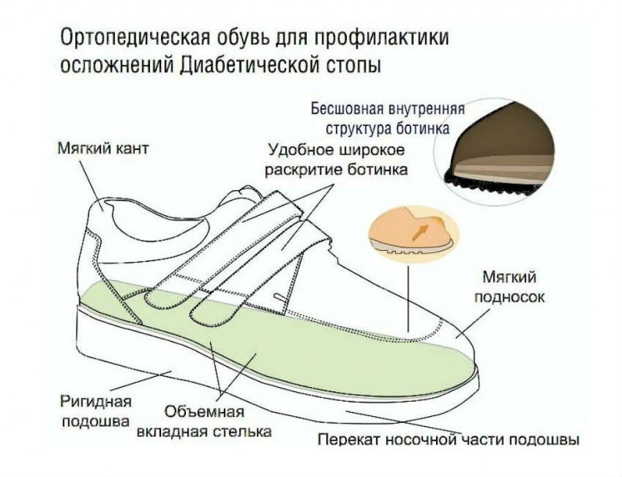 Ортопедическая обувь при сахарном диабете. Источник: sosudy.info