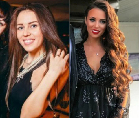 Ангелина волчек до пластики и после фото Звезды дома 2 до и после пластики, самые видимые примеры звездные истории Дзен