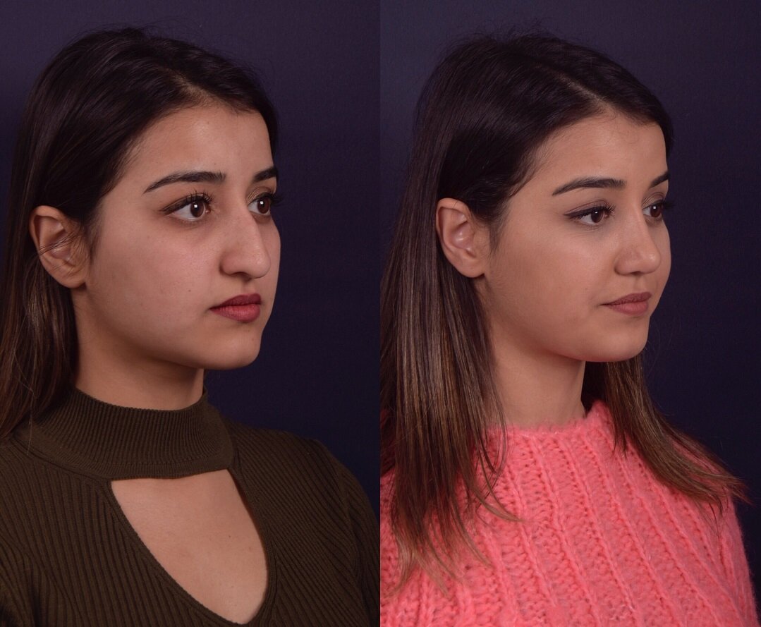 фото: @drtimurbatmaz