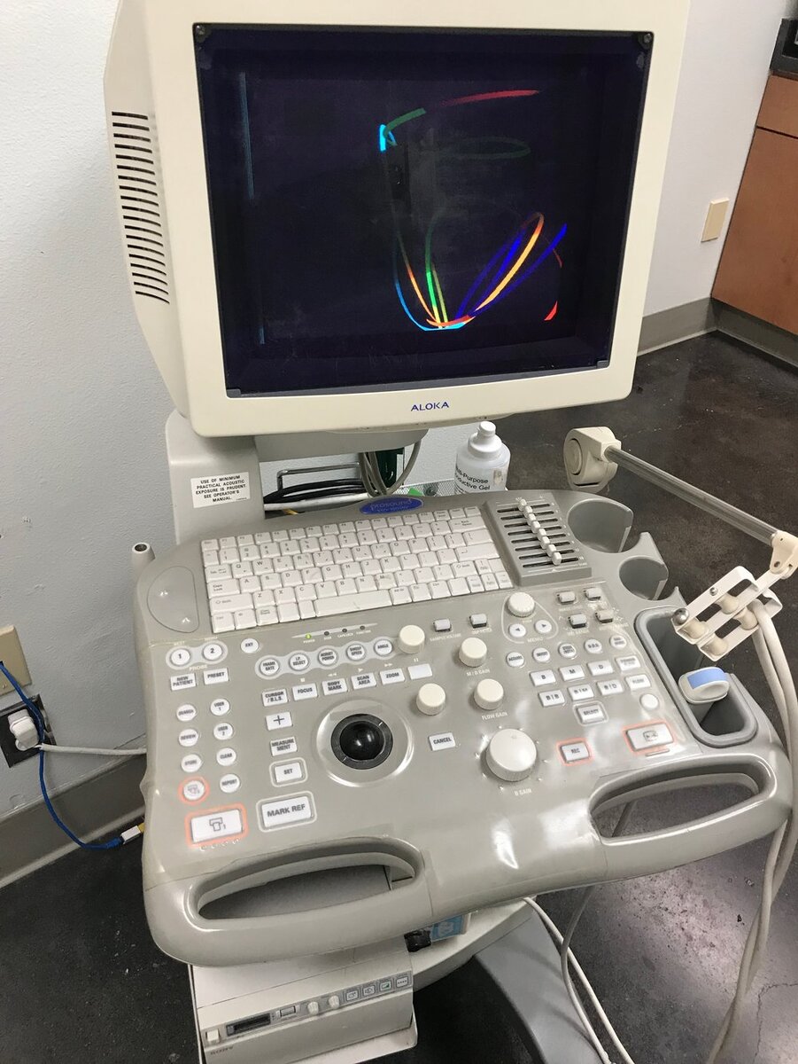 УЗИ аппарат Aloka (Алока)