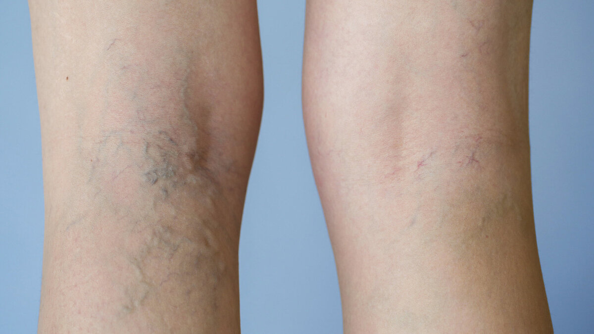 Источник фото - https://parentinghealthybabies.com/