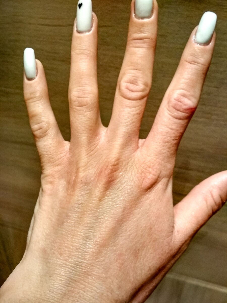 Утром после снятия перчаток