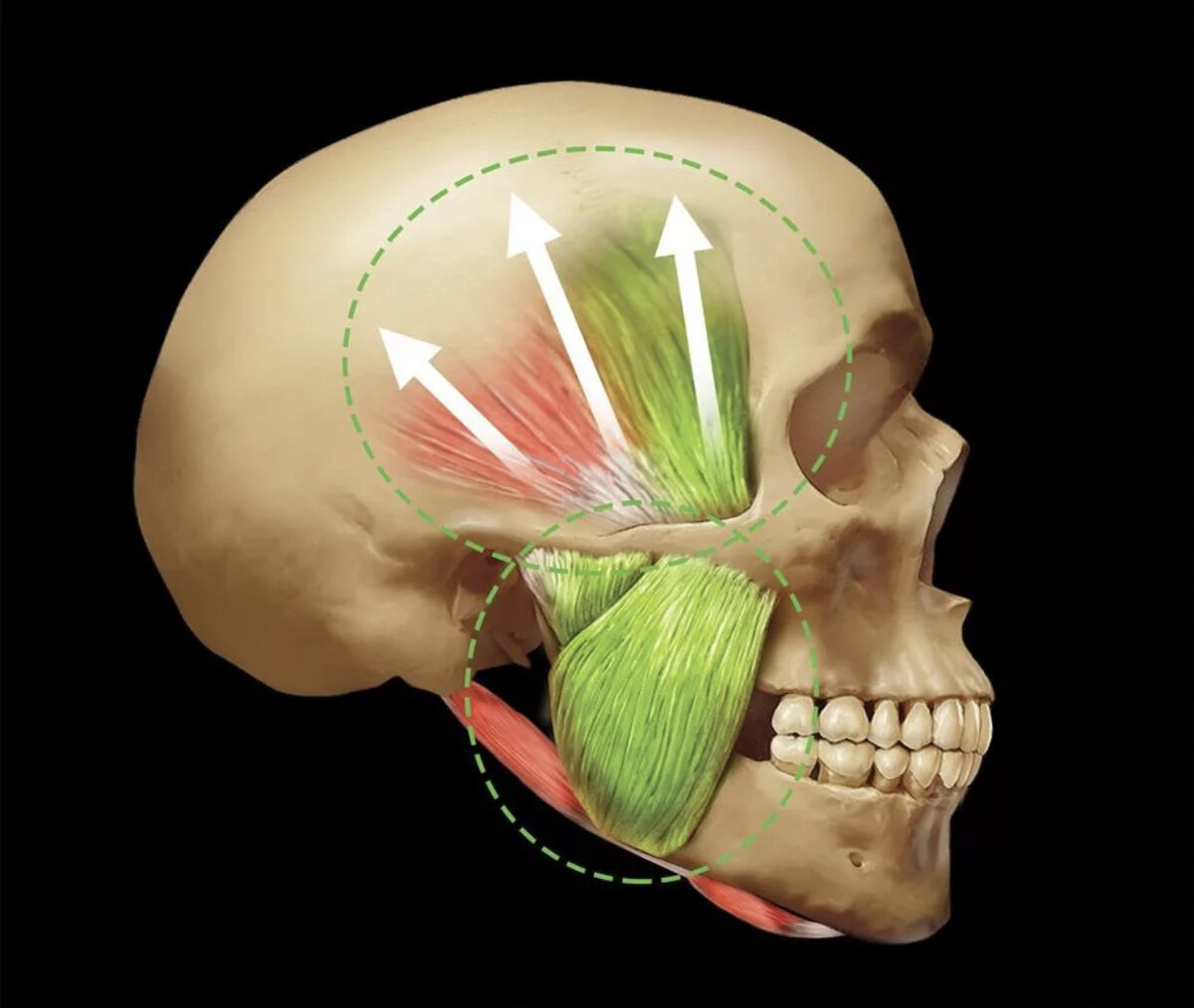 Контрактура жевательных. Биомеханика нижней челюсти ВНЧС. Биомеханика нижней челюсти анатомия.