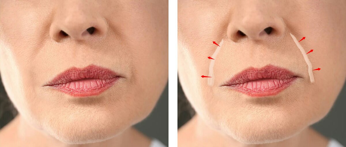 Направление растушевки консилера