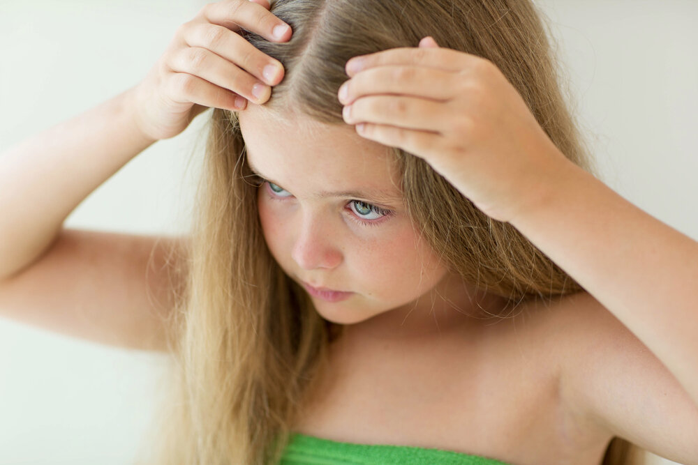 Семь неожиданных причин, почему выпадают волосы у подростков