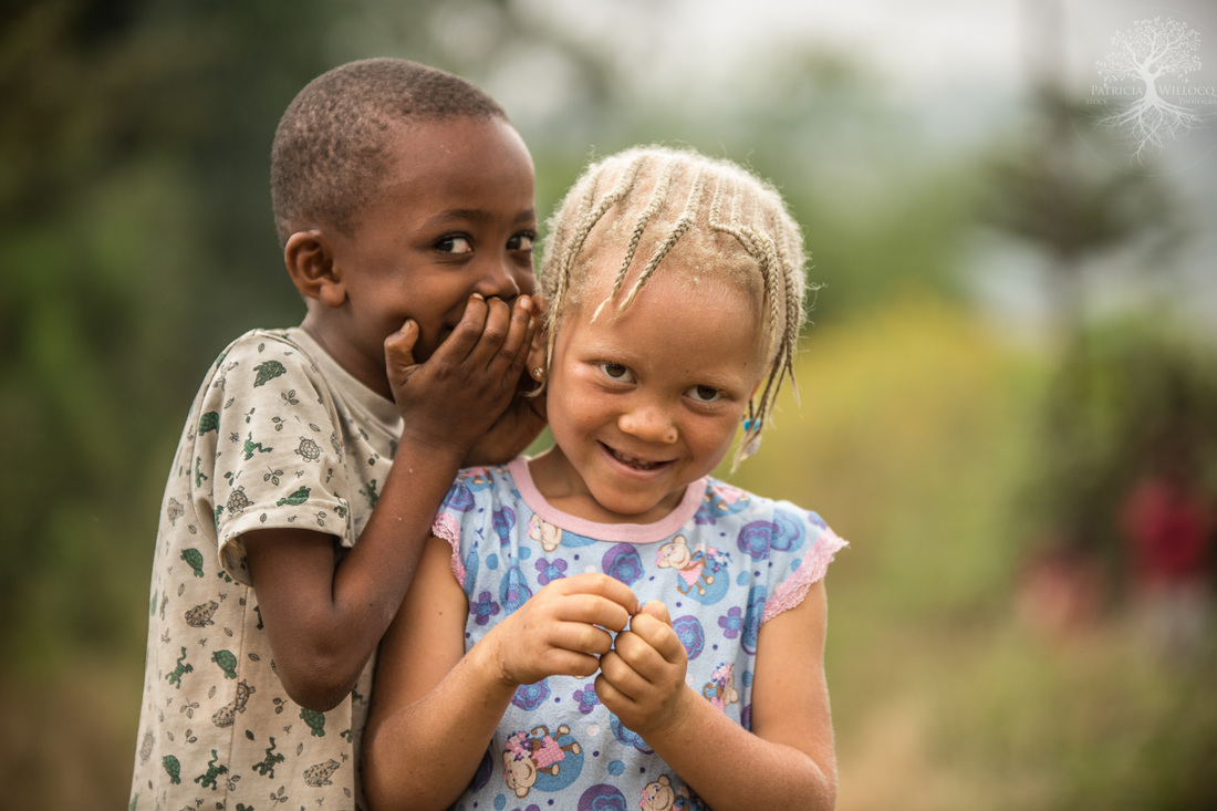 Альбинизм негроидная раса. Африканцы. Африканка с ребенком. Чернокожая белокожая