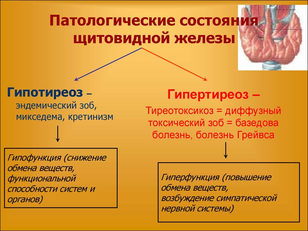 Лечение эндемического зоба в Екатеринбурге. Эндокринолог медицинского центра «УРО-ПРО».