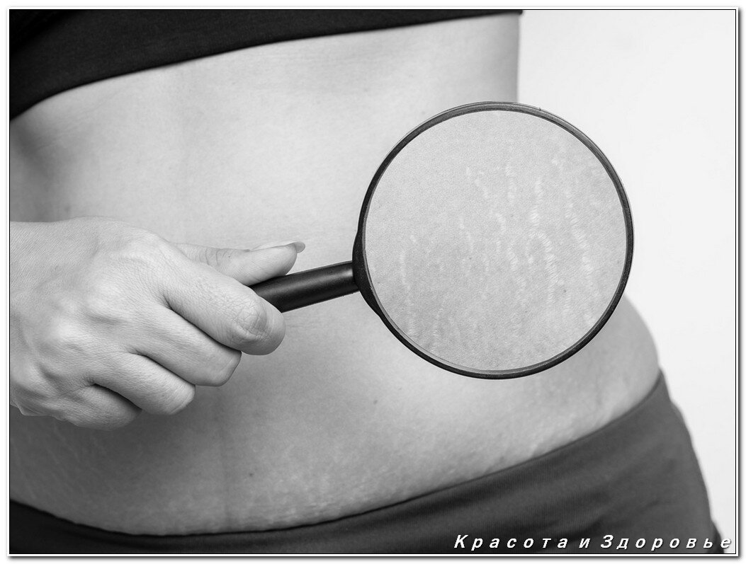 Источник фото: https://www.shamirbaby.co.il