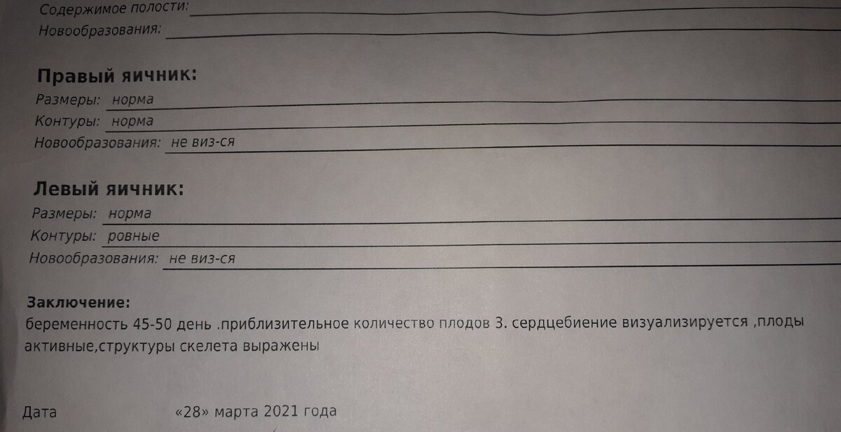 Результат УЗИ