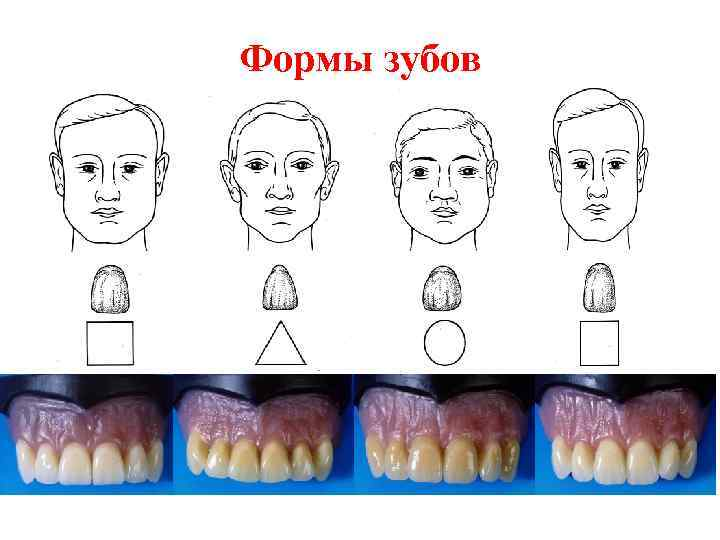 Зубы трех видов. Форма зубов по форме лица. Прямоугольные и треугольные зубы. Тип характера по форме зубов. Овальная треугольная прямоугольная форма зубов.