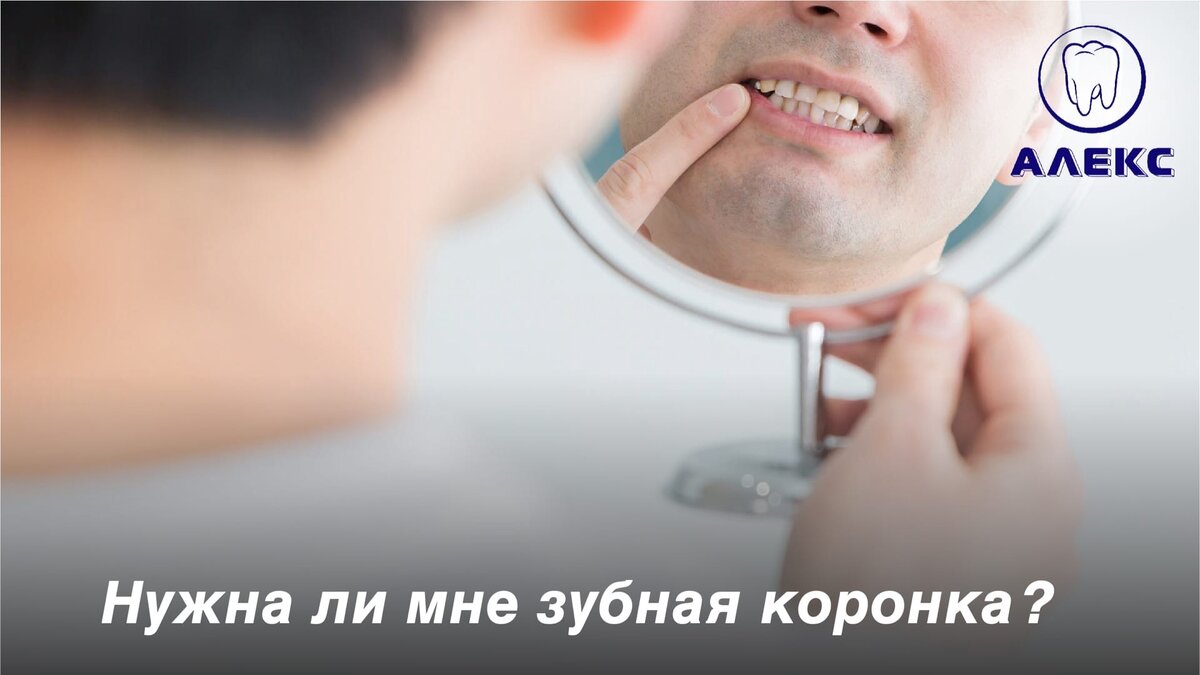 Задумываетесь о реставрации зуба коронкой? 
Нужна она вам или нет, может сказать только ваш стоматолог.
Но нужно иметь в виду, что одного желания для установки коронки недостаточно. Для проведения процедуры нужны медицинские показания:👇

🦷 более 70% верхней части зуба разрушено;
🦷 эмаль сильно повреждена;
🦷 пациенту не подходят другие способы восстановления целостности челюсти;
🦷 перелом верхней части зуба;
🦷 у пациента тонкая эмаль.

Лечение зуба может служить показанием для установки временной коронки.

Все процедуры, связанные с медицинским вмешательством, имеют как плюсы, так и минусы. Перед тем, как решиться на установку коронок, стоит сопоставить все «за» и «против».

Звоните и записывайтесь к нам на консультацию в ближайшее удобное время по тел. 📲+7(498)481-10-11, +7(498)481-24-24.
Мы с удовольствием примем вас, проведём осмотр и дадим рекомендации по подбору, установке и уходу за коронками.👍